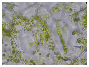 what are the different shapes of chloroplast in deifferent algal